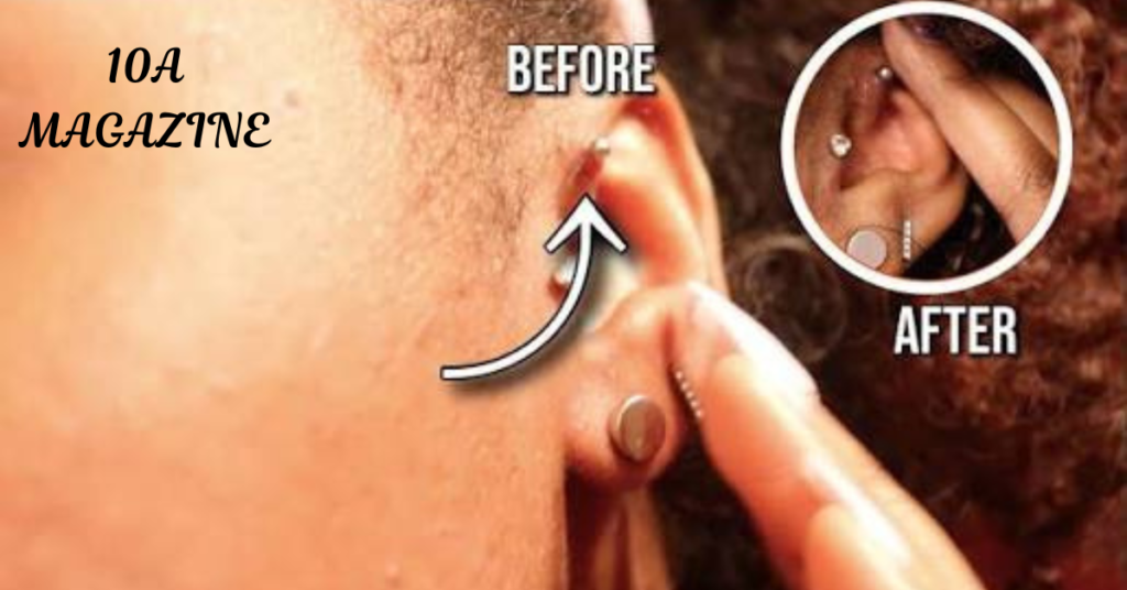 How to Get Rid of a Piercing Bump: Step-by-Step