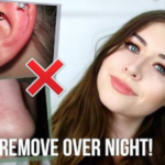 When to See a Dermatologist